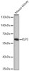 Western blot analysis of extracts of Mouse kidney using ELP3 Polyclonal Antibody at dilution of 1:1000.