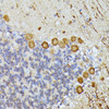 Immunohistochemistry of paraffin-embedded Mouse cerebellum using ELP3 Polyclonal Antibody at dilution of  1:100 (40x lens).