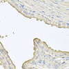 Immunohistochemistry of paraffin-embedded Human prostate using FABP12 Polyclonal Antibody at dilution of  1:100 (40x lens).