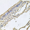 Immunohistochemistry of paraffin-embedded Human trachea using FABP12 Polyclonal Antibody at dilution of  1:100 (40x lens).