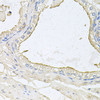 Immunohistochemistry of paraffin-embedded Human prostate using HPR Polyclonal Antibody at dilution of  1:100 (40x lens).