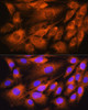 Immunofluorescence analysis of C6 cells using ATP5D Polyclonal Antibody at dilution of  1:100. Blue: DAPI for nuclear staining.