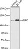 Western blot analysis of extracts of various cell lines using GLDC Polyclonal Antibody at dilution of 1:1000.