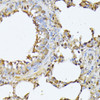 Immunohistochemistry of paraffin-embedded Rat lung using PSMB3 Polyclonal Antibody at dilution of  1:100 (40x lens).