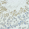 Immunohistochemistry of paraffin-embedded Rat testis using TRIP12 Polyclonal Antibody at dilution of  1:100 (40x lens).