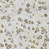 Immunohistochemistry of paraffin-embedded Mouse brain using CEP164 Polyclonal Antibody