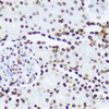 Immunohistochemistry of paraffin-embedded Rat kidney using Phospho-ABL1(Y245) Polyclonal Antibody at dilution of  1:100 (40x lens).