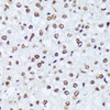 Immunohistochemistry of paraffin-embedded Mouse liver using Phospho-ABL1(Y245) Polyclonal Antibody at dilution of  1:100 (40x lens).
