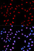 Immunofluorescence analysis of MCF-7 cells using Phospho-AKT(T450) Polyclonal Antibody