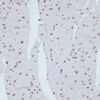 Immunohistochemistry of paraffin-embedded Rat heart using Phospho-CHEK1(S280) Polyclonal Antibody at dilution of  1:100 (40x lens).