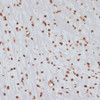 Immunohistochemistry of paraffin-embedded Mouse brain using Phospho-CHEK1(S280) Polyclonal Antibody at dilution of  1:100 (40x lens).