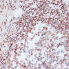 Immunohistochemistry of paraffin-embedded Human appendix using Phospho-CREB1(S133) Polyclonal Antibody at dilution of  1:100 (40x lens).