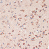 Immunohistochemistry of paraffin-embedded Mouse brain using Phospho-GSK3B(S9) Polyclonal Antibody at dilution of  1:100 (40x lens).