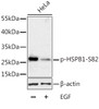 Western blot analysis of extracts of HeLa cells using Phospho-HSPB1(S82) Polyclonal Antibody at dilution of 1:1000. HeLa cells were treated by EGF (100ng/ml) for 30 minutes after serum-starvation overnight.