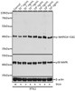 Western blot analysis of extracts of 3T3L1 cells using Phospho-MAPK14(Y182) Polyclonal Antibody at dilution of 1:1000.