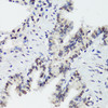 Immunohistochemistry of paraffin-embedded Rat lung using Phospho-MAPK14(Y182) Polyclonal Antibody at dilution of  1:100 (40x lens).