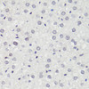 Immunohistochemistry of paraffin-embedded Rat liver using Phospho-MAPK14(Y182) Polyclonal Antibody at dilution of  1:100 (40x lens).
