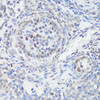 Immunohistochemistry of paraffin-embedded Rat ovary using Phospho-MAPK14(Y182) Polyclonal Antibody at dilution of  1:100 (40x lens).