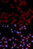 Immunofluorescence analysis of U2OS cells using Phospho-MAPK14(Y182) Polyclonal Antibody