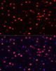 Immunofluorescence analysis of Rat brain using Phospho-Stat3(Y705) Polyclonal Antibody at dilution of  1:100 (40x lens). Blue: DAPI for nuclear staining.