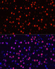 Immunofluorescence analysis of Mouse brain using Phospho-Stat3(Y705) Polyclonal Antibody at dilution of  1:100 (40x lens). Blue: DAPI for nuclear staining.