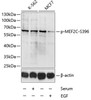 Western blot analysis of extracts of K-562 and MCF-7 cells using Phospho-MEF2C(S396) Polyclonal Antibody at dilution of 1:1000. K562 cells were treated by 10% FBS for 30 minutes after serum-starvation overnight. MCF7 cells were treated by EGF (100ng/ml) for 30 minutes after serum-starvation overnight.