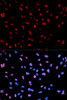 Immunofluorescence analysis of U2OS cells using Phospho-MEF2C(S396) Polyclonal Antibody