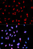 Immunofluorescence analysis of U2OS cells using Phospho-MET(Y1234) Polyclonal Antibody