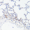 Immunohistochemistry of paraffin-embedded Rat lung using Phospho-MYC(S62) Polyclonal Antibody at dilution of  1:100 (40x lens).