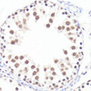 Immunohistochemistry of paraffin-embedded Rat testis using Phospho-MYC(S62) Polyclonal Antibody at dilution of  1:100 (40x lens).