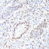 Immunohistochemistry of paraffin-embedded Human appendix using Phospho-MYC(S62) Polyclonal Antibody at dilution of  1:100 (40x lens).