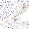 Immunohistochemistry of paraffin-embedded Mouse lung using Phospho-MYC(S62) Polyclonal Antibody at dilution of  1:100 (40x lens).