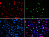 Immunofluorescence analysis of GFP-RNF168 transgenic U2OS cells using Phospho-p53(S15) Polyclonal Antibody