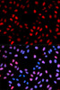 Immunofluorescence analysis of U2OS cells using Phospho-RAF1(S621) Polyclonal Antibody