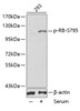 Western blot analysis of extracts of 293 cell line using Phospho-RB(S795) Polyclonal Antibody.