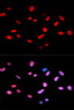Immunofluorescence analysis of U2OS cells using Phospho-Rb(S811) Polyclonal Antibody