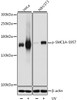 Western blot analysis of extracts of various cell lines using Phospho-SMC1A(S957) Polyclonal Antibody at dilution of 1:1000. HeLa and NIH/3T3 cells were treated by UV for 15-30 minutes.