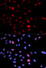Immunofluorescence analysis of U2OS cells using Phospho-SMC1A(S957) Polyclonal Antibody