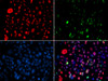 Immunofluorescence analysis of GFP-RNF168 transgenic U2OS cells using Phospho-SMC1A(S957) Polyclonal Antibody