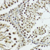 Immunohistochemistry of paraffin-embedded Rat testis using Phospho-Histone H3(T11) Polyclonal Antibody at dilution of  1:100 (40x lens).