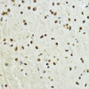 Immunohistochemistry of paraffin-embedded Mouse brain using Phospho-Histone H3(T11) Polyclonal Antibody at dilution of  1:100 (40x lens).