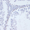 Immunohistochemistry of paraffin-embedded Rat testis using Phospho-γH2A.X(S139) Polyclonal Antibody at dilution of  1:200 (40x lens).