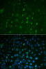 Immunofluorescence analysis of U2OS cells using Phospho-γH2A.X(S139) Polyclonal Antibody at dilution of  1:100. Blue: DAPI for nuclear staining.