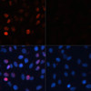 Immunofluorescence analysis of C6 cells using Phospho-γH2A.X(S139) Polyclonal Antibody at dilution of  1:100. Blue: DAPI for nuclear staining.C6 cells were treated by UV for 15-30 minutes at RT (left). Blue: DAPI for nuclear staining.