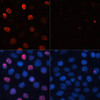 Immunofluorescence analysis of HeLa cells using Phospho-γH2A.X(S139) Polyclonal Antibody at dilution of  1:100. Blue: DAPI for nuclear staining.HeLa cells were treated by UV for 15-30 minutes at RT (left). Blue: DAPI for nuclear staining.