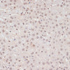 Immunohistochemistry of paraffin-embedded Rat liver using Phospho-STAT1(S727) Polyclonal Antibody at dilution of  1:100 (40x lens).