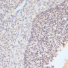 Immunohistochemistry of paraffin-embedded Rat ovary using Phospho-STAT1(S727) Polyclonal Antibody at dilution of  1:100 (40x lens).