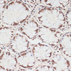 Immunohistochemistry of paraffin-embedded Human colon using Phospho-PRKAA1(T183）/PRKAA2（T172） Polyclonal Antibody at dilution of  1:100 (40x lens).