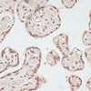 Immunohistochemistry of paraffin-embedded Human placenta using Phospho-PRKAA1(T183）/PRKAA2（T172） Polyclonal Antibody at dilution of  1:100 (40x lens).