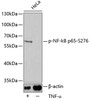 Western blot analysis of extracts of HeLa cells using Phospho-NF-kB p65(S276) Polyclonal Antibody.